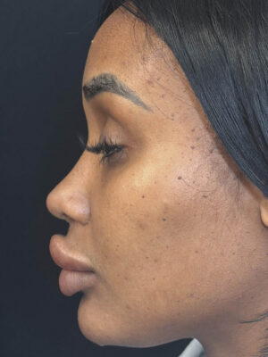 Barbie Nose